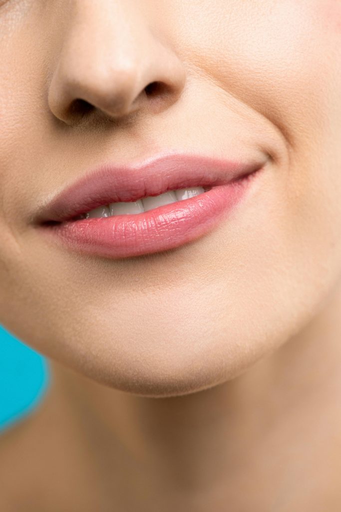 Botox muschiul mentonier barbie bucuresti