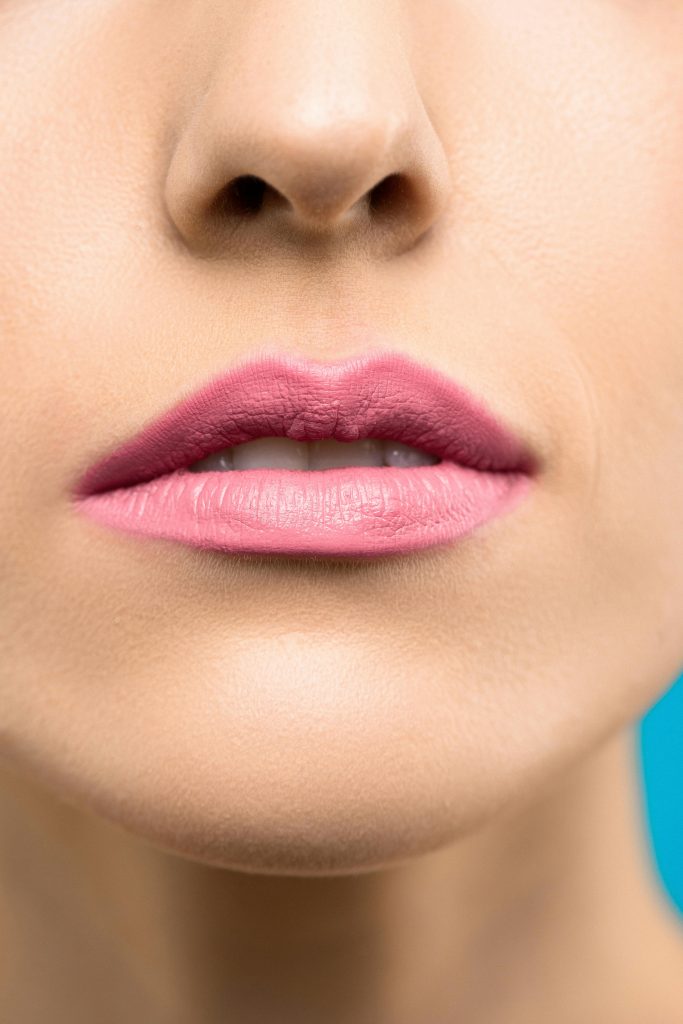 Corectare santuri nazogeniene cu acid hialuronic