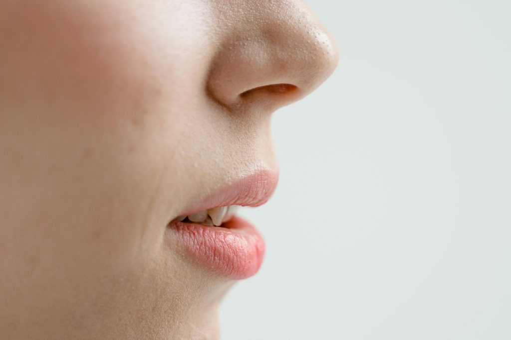 Ridicare varf nas cu botox